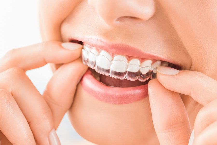 ortodonzia a Verona - Dentista Delazzari